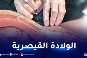 أكثر من 40% من الولادات القيصرية عمليات تتم تحت طلب الأمهات الحوامل