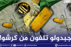 مصر.. إستخراج هاتف محمول من معدة مريض!
