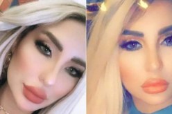 وفاة شابة تونسية أثناء عملية شفط الدهون