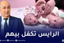 رئيس الجمهورية يتكفل شخصيا بفصل توأمين وإجراء عملية جراحية بتركيا