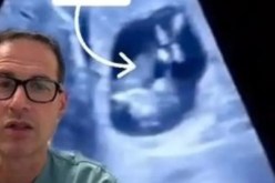 حالة طبية نادرة.. جنين ينمو داخل كبد والدته