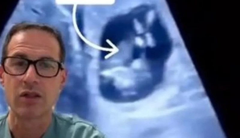 حالة طبية نادرة.. جنين ينمو داخل كبد والدته