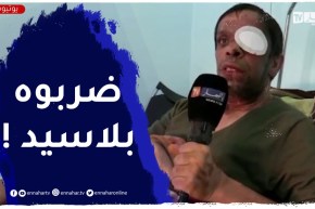كارثة.. إعتداء على أستاذ بحمض الأسيد بخنشلة..الأستاذ يروي قصة الحادثة
