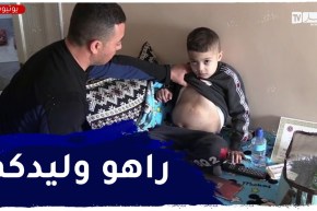 خنشلة: عائلة الطفل ساجد تناشد المحسنين لإجراء عملية جراحية
