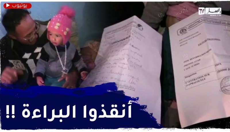 غليزان : عائلة الطفلة آية تناشد المحسنين لمساعدة إبنتها على إجراء عملية مستعجلة