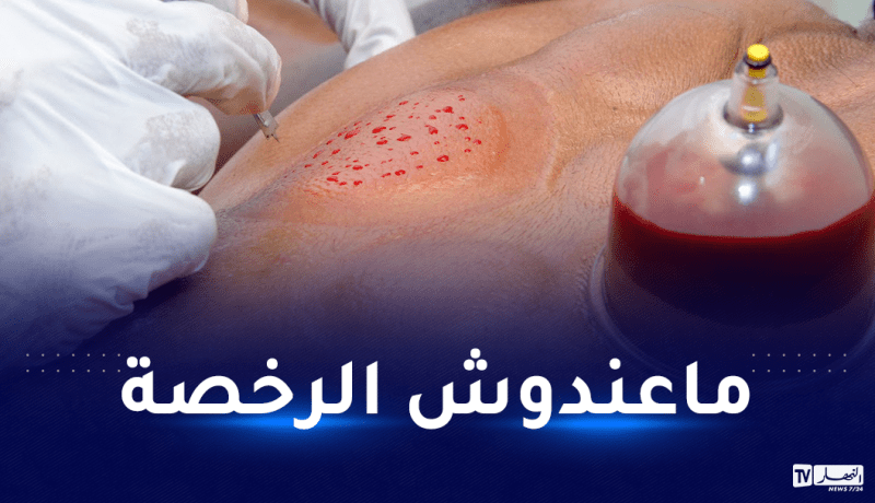 غليزان..توقيف طبيب مزيف يمتهن الحجامة والمعالجة بالطب البديل عبر الفايسبوك