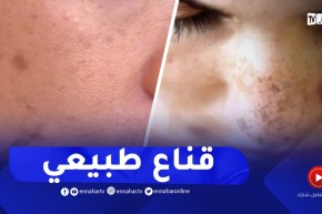 مع السفيرة: قناع طبيعي للتخلص من البقع البنية