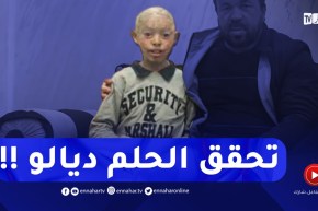 الحمد الله..تم جمع المبلغ المطلوب لعلاج الطفل صاحب الجلد السمكي