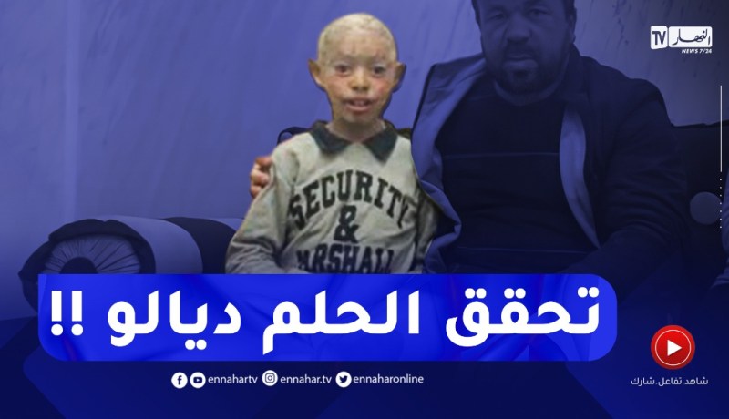 الحمد الله..تم جمع المبلغ المطلوب لعلاج الطفل صاحب الجلد السمكي