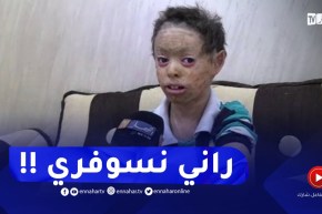 “مرض نادر يحول الطفل حسين لسمكة..”راني نسوفري نخاف تبهدلني المعلّمة !!