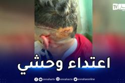 المدرب حميسي “يا أيها المعتدي هل ستنام الليلة وضميرك مرتاح”