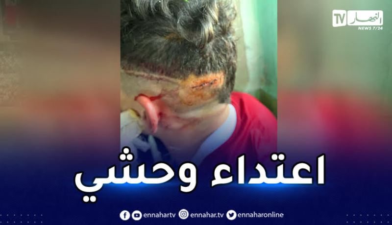 المدرب حميسي “يا أيها المعتدي هل ستنام الليلة وضميرك مرتاح”