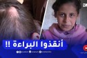 البويرة : ورم خطير يهـدد حياة الطفلة مريم من بلدية الدشيمة