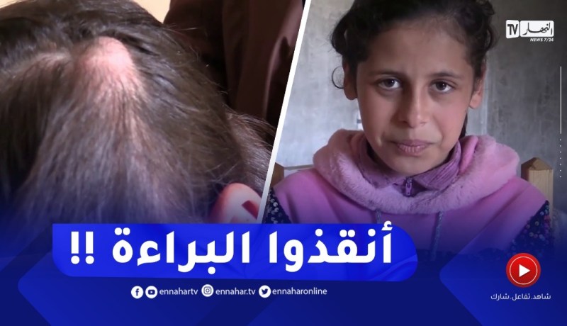 البويرة : ورم خطير يهـدد حياة الطفلة مريم من بلدية الدشيمة