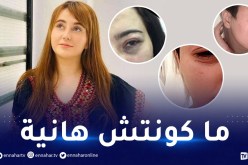 صور وجه طليقة محمد بن شنات تشعل المواقع!