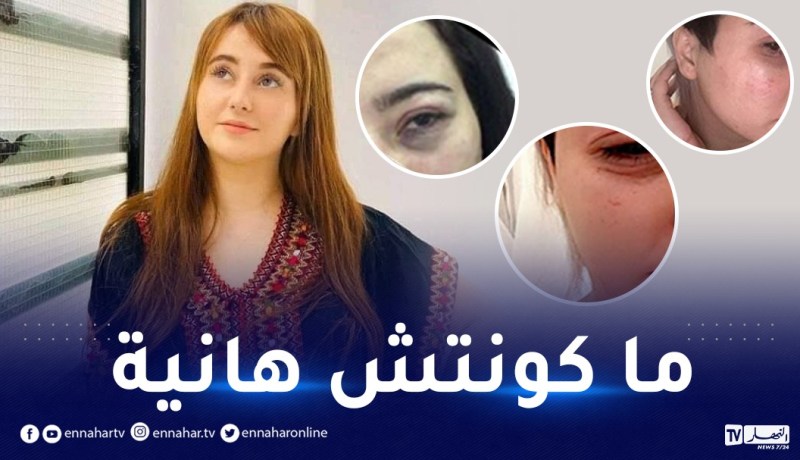 صور وجه طليقة محمد بن شنات تشعل المواقع!
