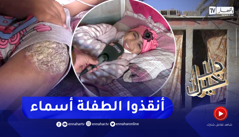 دلال خير: مأساة تعيشها عائلة بأولاد جلال.. طفلة أرهقها مرض السرطان وسط فقر مدقع للعائلة