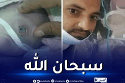 فيديو.. ولادة طفل بعين واحدة!