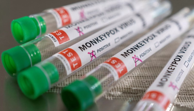 الإمارات تعلن رصد أول حالة بجدري القرود