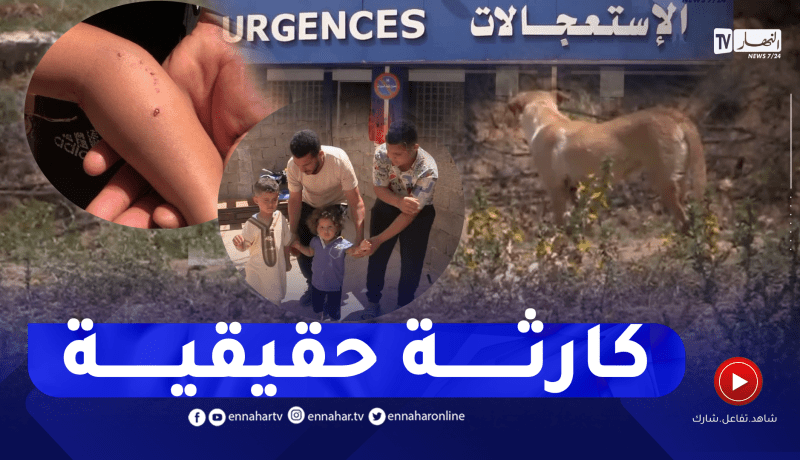 غليزان: إصابة طفلين بعـ.ضات كلب مسعـ.ور.. النهار تروي تفاصيل القصة الكاملة