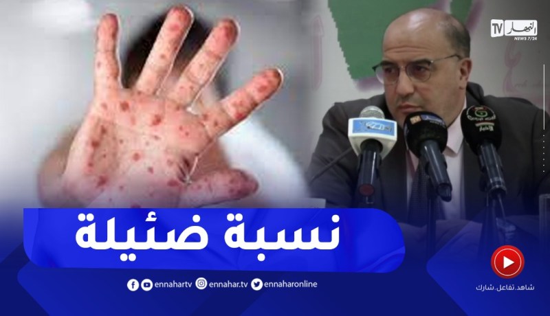 فوزي درار : نسبة خطورة جدري القردة ضئيلة لكن علينا أن نكون حذرين