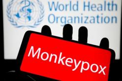 منظمة الصحة العالمية تسجل 200 إصابة بجدري القرود في 20 دولة