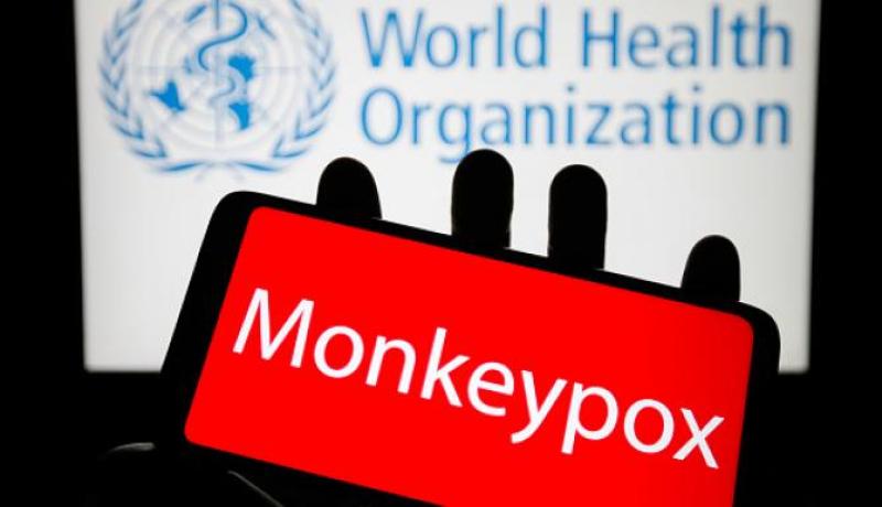 منظمة الصحة العالمية تسجل 200 إصابة بجدري القرود في 20 دولة