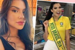 عملية جراحية بسيطة تودي بحياة ملكة جمال البرازيل