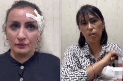 إمرأة تبيع مولودتها لإجراء عملية تجميل لأنفها!!