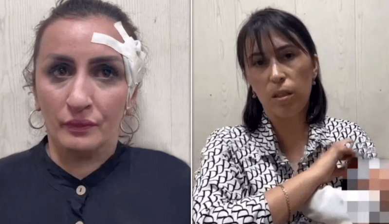 إمرأة تبيع مولودتها لإجراء عملية تجميل لأنفها!!