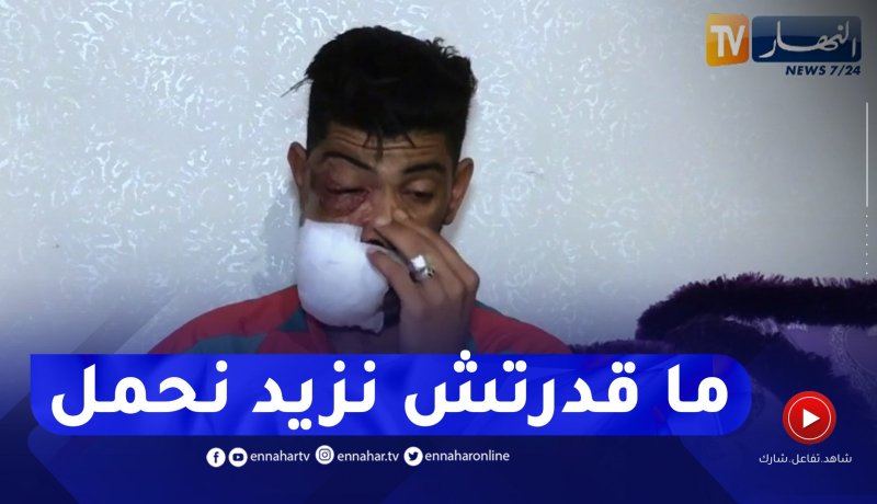 الصديق مصاب بورم بالوجه.. يناشد السلطات لمواصلة العلاج بالخارج