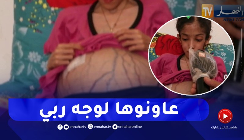 طالع هابط: النوي يذرف الدموع و يناشد المحسنين التكفل بحالة الطفلة سمية ونقلها للعلاج ببلجيكا