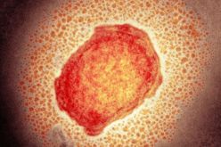 منظمة الصحة تعلن تفشي فيروس “ماربورغ” في دولة إفريقية