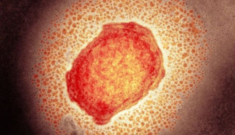 ووهان تثير الخوف من جديد.. إكتشاف بكتيريا مسببة لمرض خطير