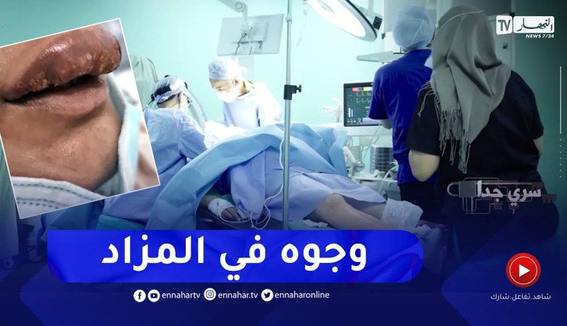 سري جدا:  في غياب الرقابة..  حلاقات برتبة مختصات في الجراحة والتجميل