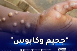 مُصاب يروي.. هذا مايحدث للجسم عند الإصابة بجدري القردة!