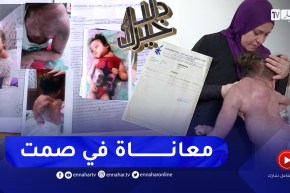 دلال خير: غياب أجهزة الكشف المبكر عن المرض وغلاء ونذرة الأدوية تحول حياة الطفلين رزان وخليل إلى جحيم