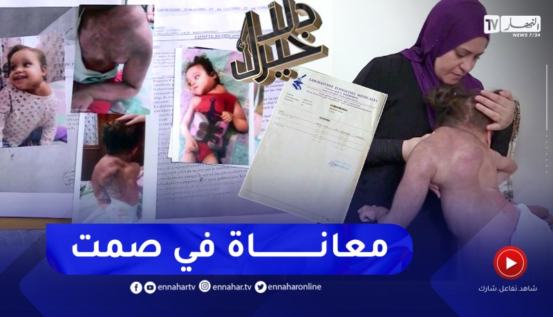 دلال خير: غياب أجهزة الكشف المبكر عن المرض وغلاء ونذرة الأدوية تحول حياة الطفلين رزان وخليل إلى جحيم