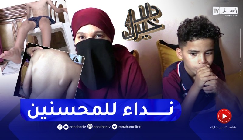 دلال خير: طفل يعاني من مرض النمو الغير طبيعي للعضام.. ويحتاج للجراحة خارج الوطن