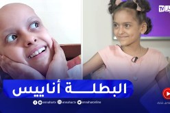 “نور الهدى: “هذا واش درت كي بدا شعر اناييس يطيح بسبب الكيماوي