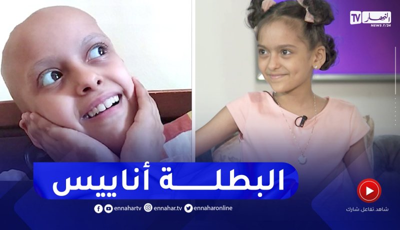 “نور الهدى: “هذا واش درت كي بدا شعر اناييس يطيح بسبب الكيماوي