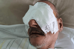 عنابة.. مختل عقليا يقتلع أعين مريض آخر بالمؤسسة الإستشفائية أبو بكر الرازي