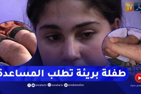 دلال خير: حادثة في المنزل شوّهـ.ت جسد الطفلة جوهرة.. تطلب من المحسنين مساعدها في العلاج