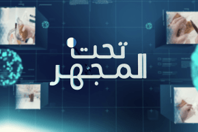 تحت المجهر: مأكولات الشاطئ.. “الشاي الأخضر” هل يطابق الشروط الصحية والجودة ؟