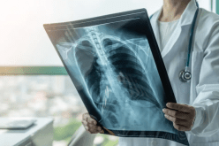 هذه خطورة تكرر الإصابة بكوفيد