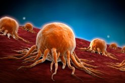 علاج جديد يحقق نتائج واعدة أمام سرطان “البروستات”