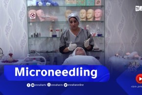 نهاركم جديد/ تقنية “Microneedling”.. كل ما يجب أن تعرفيه حولها