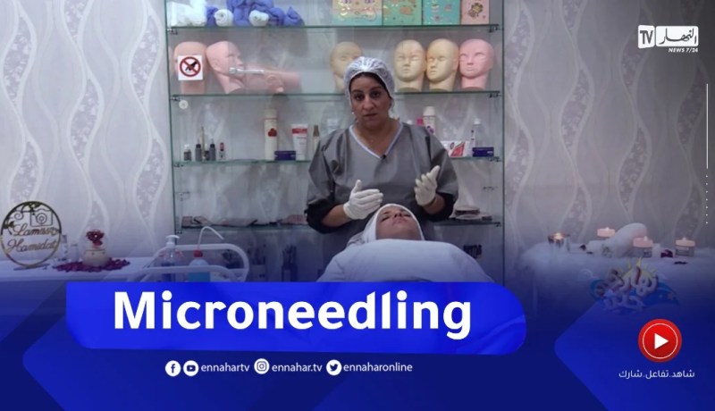 نهاركم جديد/ تقنية “Microneedling”.. كل ما يجب أن تعرفيه حولها