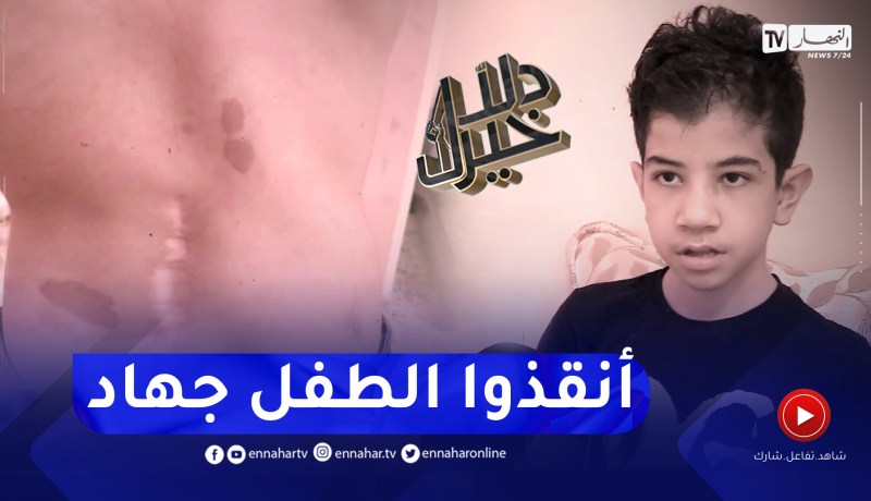 دلال خير: طفل أصيب بإعوجاج العمود الفقري في حادث منزلي عجزت العائلة من تأمين تكاليف العلاج