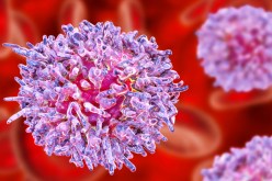 5 طرق يمكنك من خلالها تجنب الإصابة بالسرطان